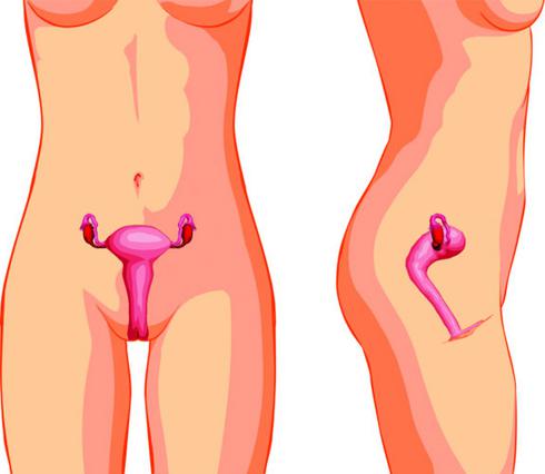 Τα εσωτερικά γεννητικά όργανα  της γυναίκας σε τομή εμπρός και  στο πλάι.