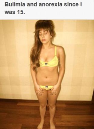 Βουλημία και ανορεξία από τότε που ήμουν 15 γράφει η Lady Gaga επάνω από τη φωτογραφία που ανεβάζει στο Twitter της. Στη συνέχεια εξηγεί ότι τώρα πια έχει μπει στο κίνημα  επανάσταση του σώματος  με σ