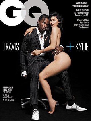 Το μοναδικό ψεγάδι της Kylie Jenner: Έτσι απέκτησε την τεράστια ουλή στο αριστερό της πόδι 
